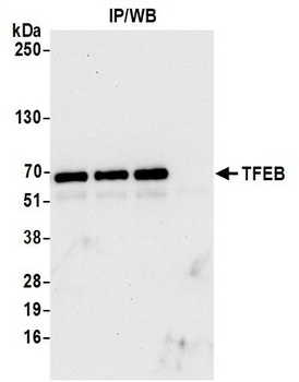 Rabbit anti-TFEB Antibody