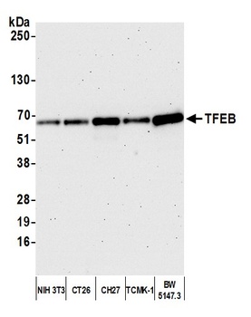 Rabbit anti-TFEB Antibody