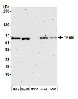Rabbit anti-TFEB Antibody