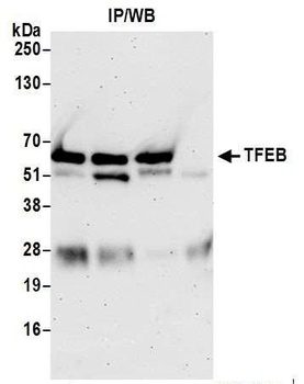 Rabbit anti-TFEB Antibody
