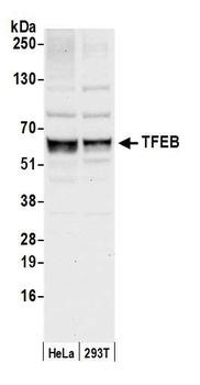 Rabbit anti-TFEB Antibody