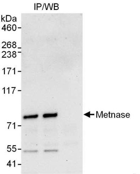 Rabbit Metnase Antibody