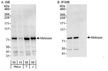 Rabbit Metnase Antibody