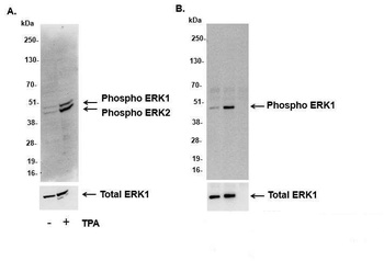 Rabbit Phospho ERK1/2 (T202/Y204, T185/Y187) Antibody