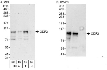 Rabbit ODF2 Antibody