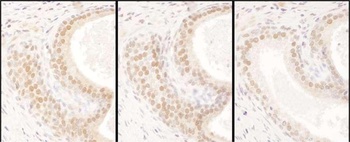 Rabbit USF2 Antibody