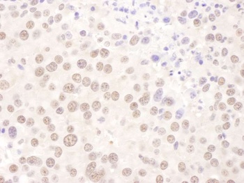 Rabbit USF2 Antibody