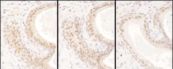 Rabbit USF2 Antibody