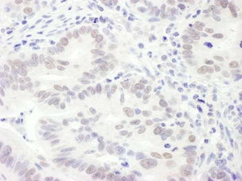 Rabbit anti-EDD1 Antibody