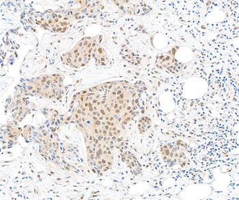 Rabbit TBP1 Antibody