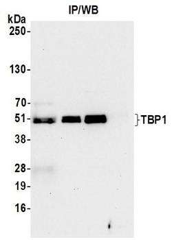 Rabbit TBP1 Antibody