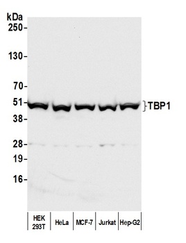 Rabbit TBP1 Antibody