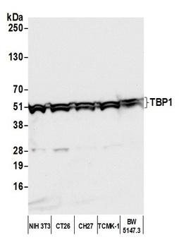 Rabbit TBP1 Antibody