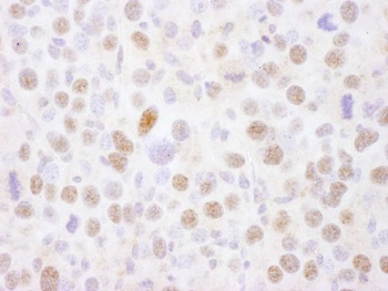 Rabbit MEF2A Antibody