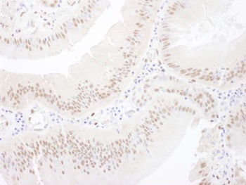 Rabbit MEF2A Antibody