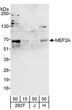 Rabbit MEF2A Antibody