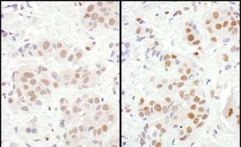 Rabbit MEF2D Antibody