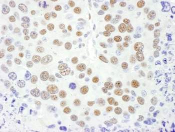 Rabbit MEF2D Antibody