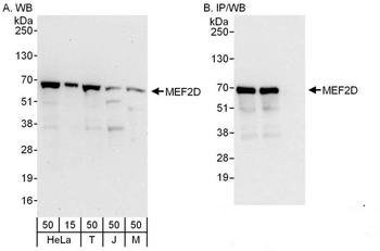 Rabbit MEF2D Antibody