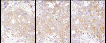 Rabbit STAT2 Antibody