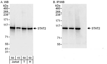 Rabbit STAT2 Antibody