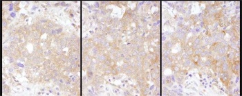 Rabbit STAT2 Antibody