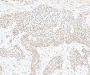 Rabbit TAF1 Antibody