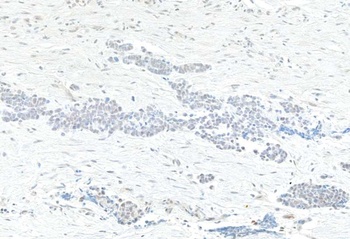 Rabbit TAF1 Antibody