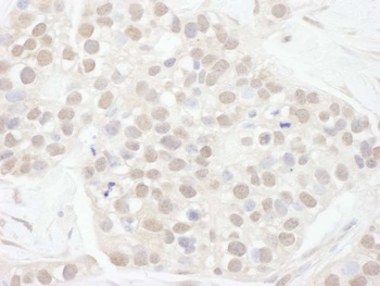 Rabbit Cyclin T1 Antibody