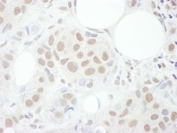 Rabbit Cyclin T1 Antibody