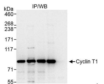 Rabbit Cyclin T1 Antibody