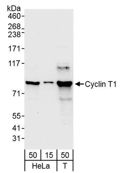 Rabbit Cyclin T1 Antibody