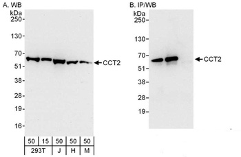 Rabbit CCT2 Antibody