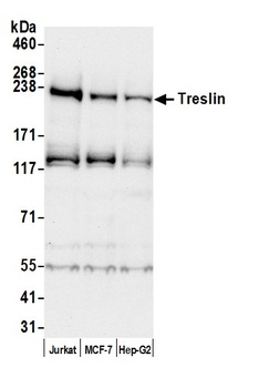 Rabbit Treslin Antibody