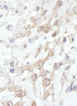 Rabbit ROC1 Antibody
