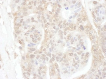 Rabbit ROC1 Antibody