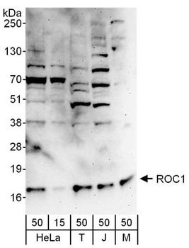 Rabbit ROC1 Antibody