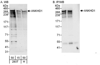 Rabbit anti-ANKHD1 Antibody