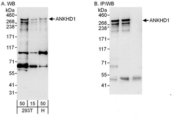 Rabbit anti-ANKHD1 Antibody