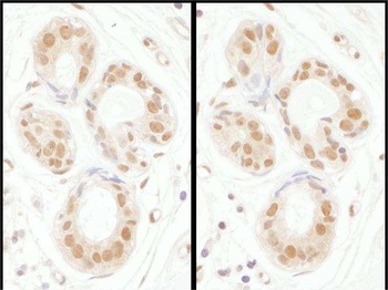 Rabbit SENP3 Antibody