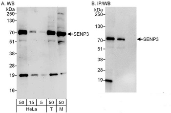 Rabbit SENP3 Antibody