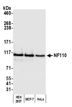 Rabbit NF110 Antibody