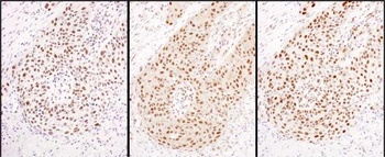 Rabbit anti-HEXIM1 Antibody