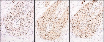 Rabbit anti-HEXIM1 Antibody