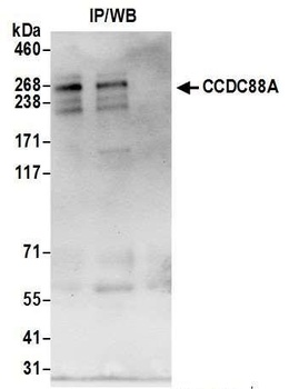 Rabbit CCDC88A Antibody