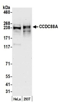 Rabbit CCDC88A Antibody