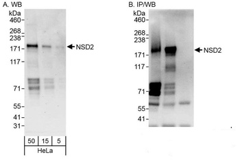 Rabbit NSD2 Antibody