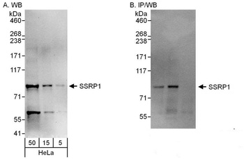 Rabbit SSRP1 Antibody