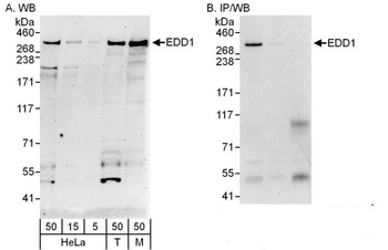 Rabbit anti-EDD1 Antibody