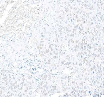 Rabbit RFX1 Antibody